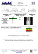 Sheabrand CBD Transdermal Patches 4-Pack Sheabrand